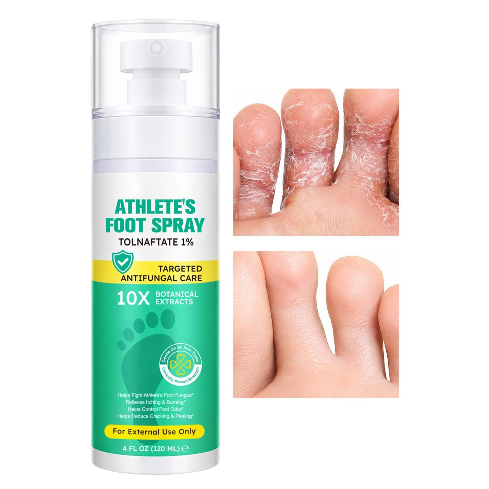Spray para pies de atletas, 120 ml para el cuidado calmante de los pies, spray antipicazón, para adultos, mujeres, hombres, corredores, vestuarios, viajes, hogar, gimnasio, salón, rutina diaria