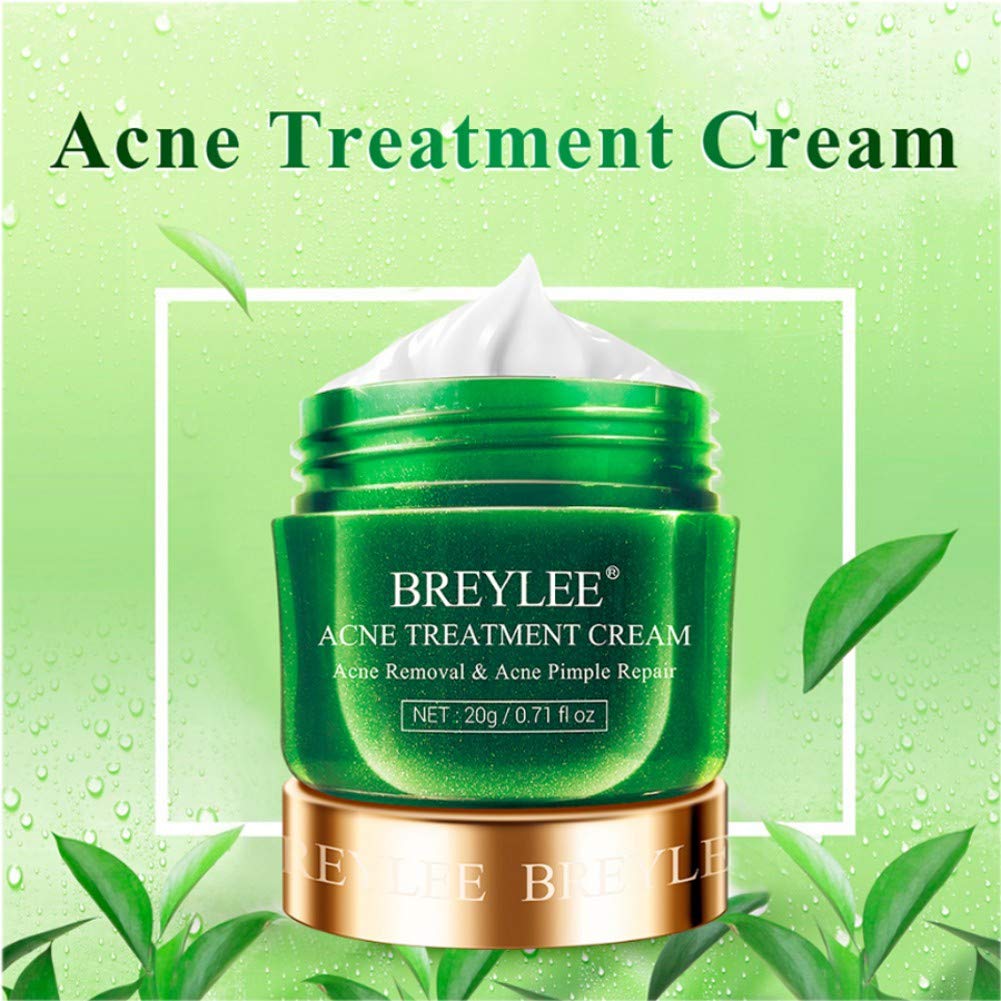 Reparación del acné cicatrices Crema antiacné facial Crema antiacné Crema antiacné Pimple Oil Control Reencoger los poros Sérum Hidratante para la cara