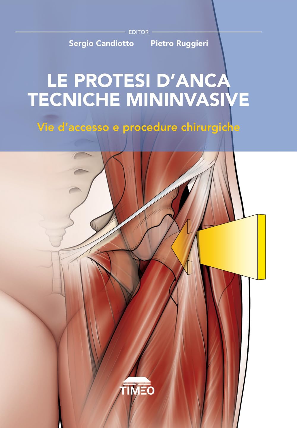 Le protesi d’anca. Tecniche mininvasive. Vie d’accesso e procedure chirurgiche. Ediz. illustrata