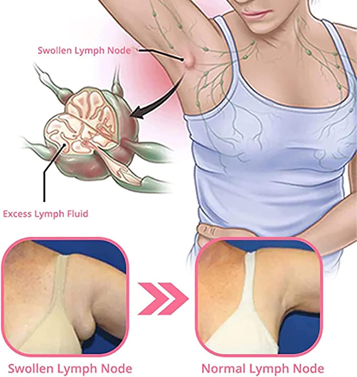 Lymphvity MagneTherapy Germanium oorbellen, lymfedrainage