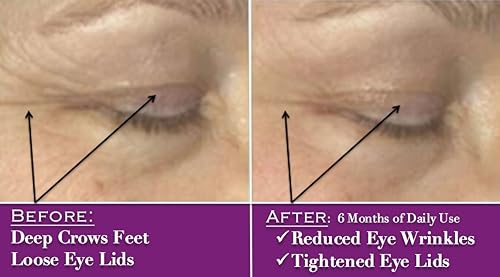 Miniatura 5 de Purest ácido hialurónico natural y orgánico, con vitamina C y E, desvanece arrugas, promueve la producción de colágeno