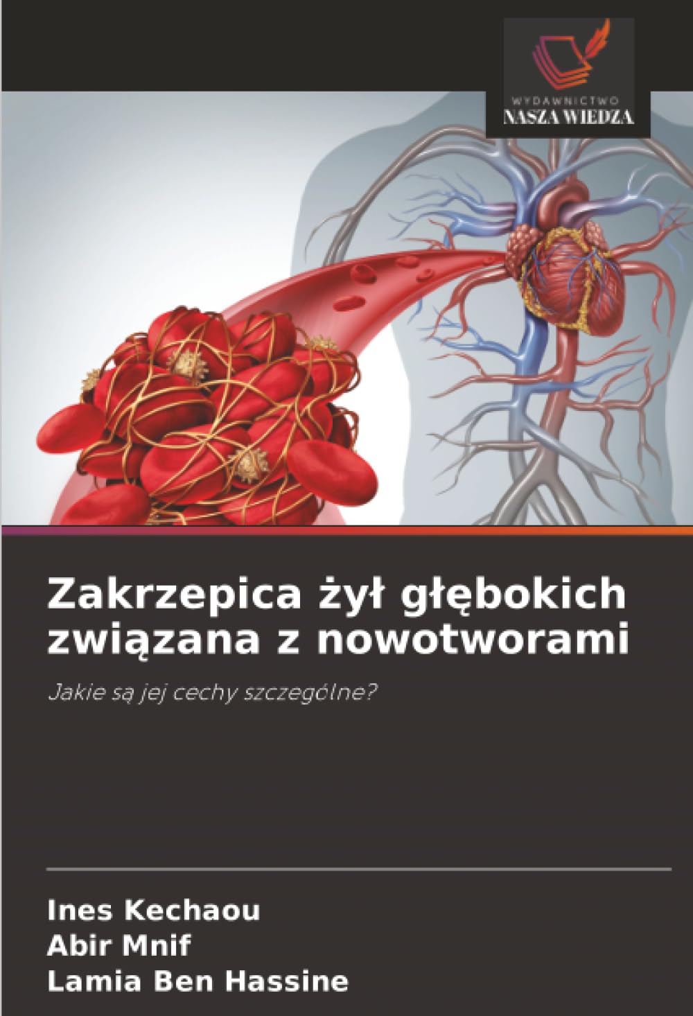 Zakrzepica ¿y¿ g¿¿bokich zwi¿zana z nowotworami: Jakie s¿ jej cechy szczególne?