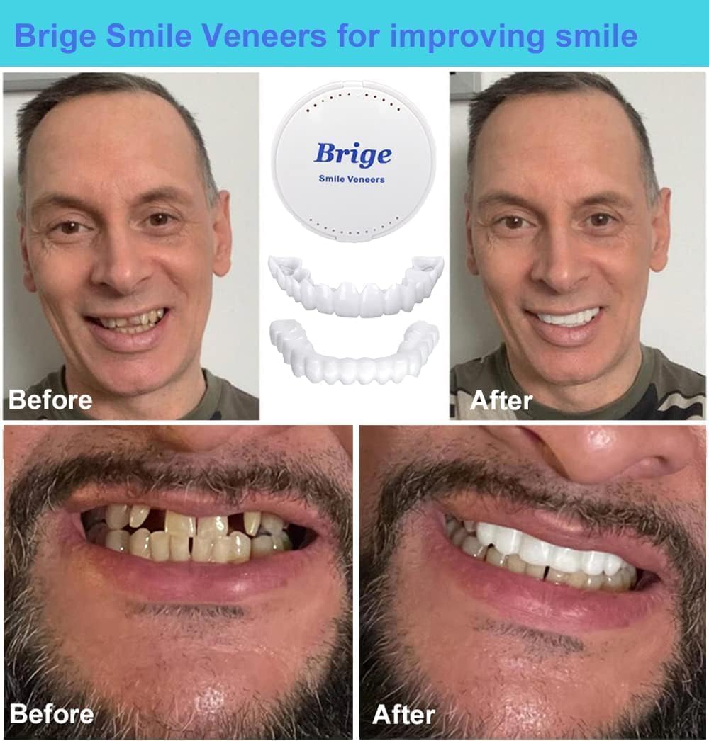 Instant Perfect Smile Comfort Fit Flex Teeth Veneers – Natural Denture Covers for Upper and Lower Teeth, Whiten & Enhance Smile, Easy Fit, Removable Cosmetic Dental Solution 4