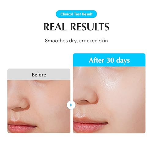 Miniatura 6 de Ampolla de piscina de 1.69 onzas líquidas, suero de ácido hialurónico para cara, impulso diario de hidratación con complejo 5-CICA, calmante para