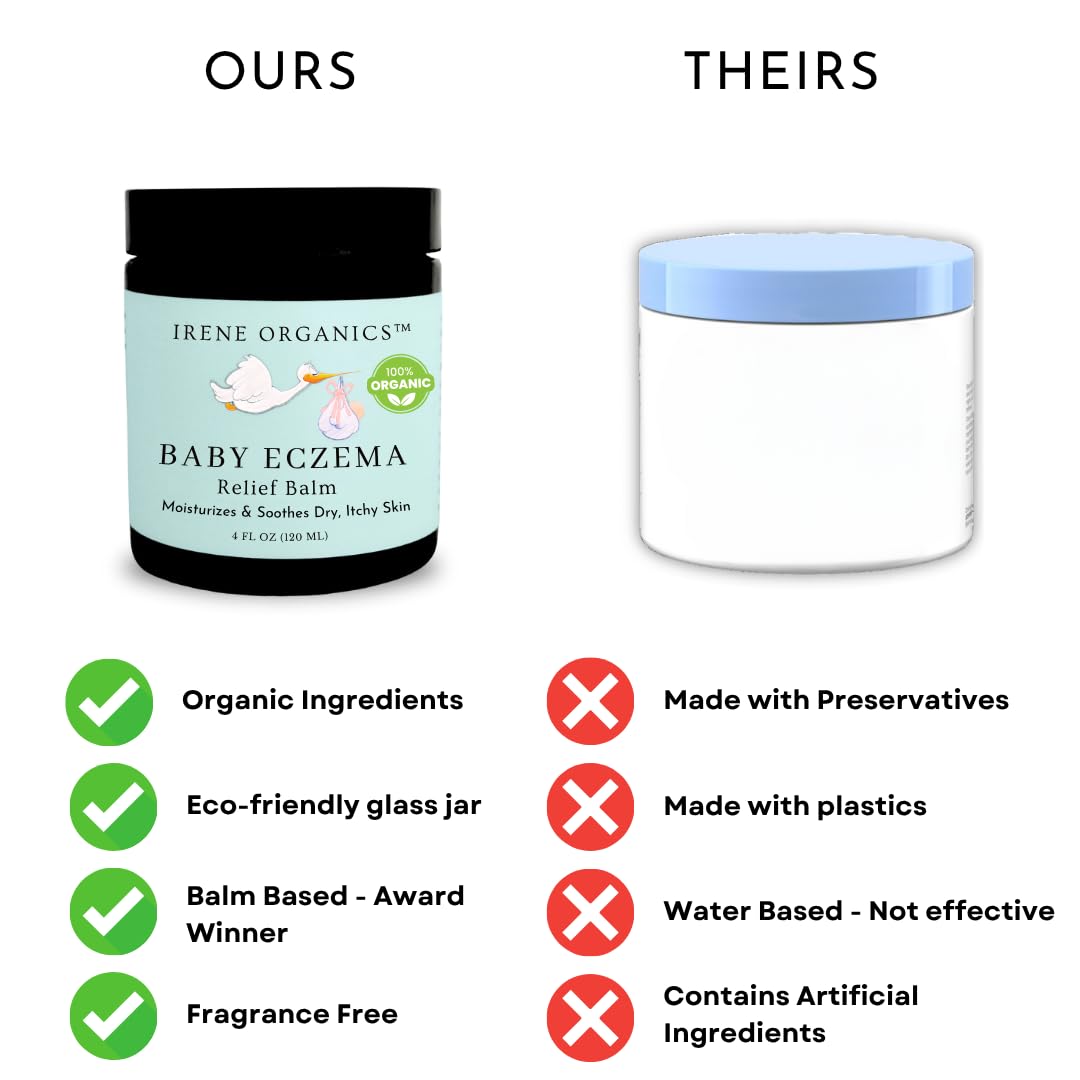 Irene Organics Baby Eczema Relief Balm, Healing Ointment Baby Moisturizing Cream for Eczema, Dry, Itchy Skin. Award Winning Baby Skincare for Sensitive Skin, Safe for Newborns, Kids and Adults