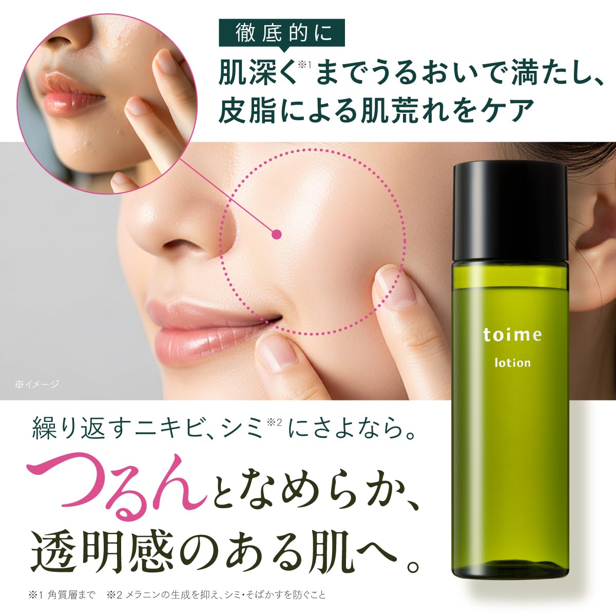 Amazon | 大人ニキビケア 化粧水 敏感肌 毛穴 シミ予防 皮脂 抗炎症
