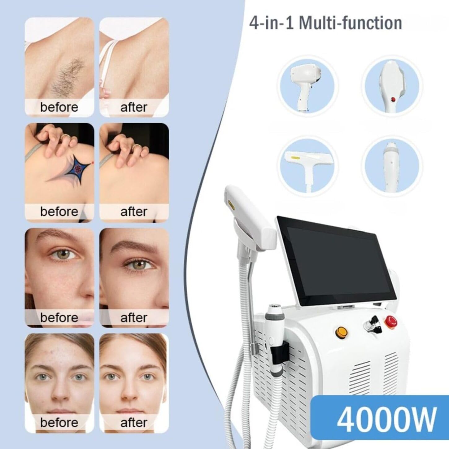 Dispositivo Estetico 4 in 1 per Viso e Corpo | Depilazione, Trattamento della Pelle, Raffreddamento a Ghiaccio, Adatto a Tutti i Tipi di Pelle
