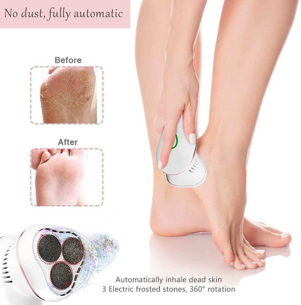 Aspirateur électrique pour callosités des Pieds - Outils de meulage de pédicure exfoliant - Réparation Automatique des Pieds, Facile à Utiliser - Traitement Professionnel des Peaux mortes/du