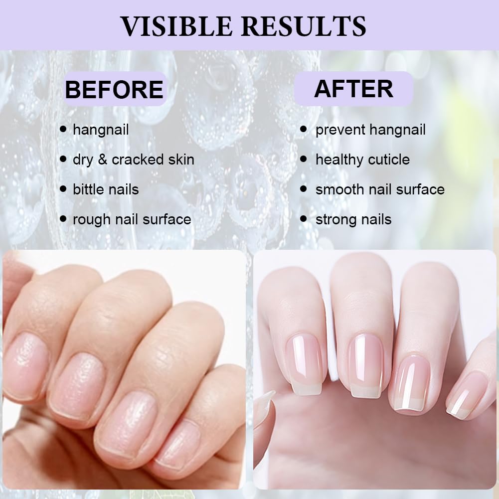 LOPHE Hydrating Cuticle Oil, 3pcs Cuticle Oil for Nails Nail and Cuticles Oils Contain Vitamin B, Moisturizes Cuticles - Image 3