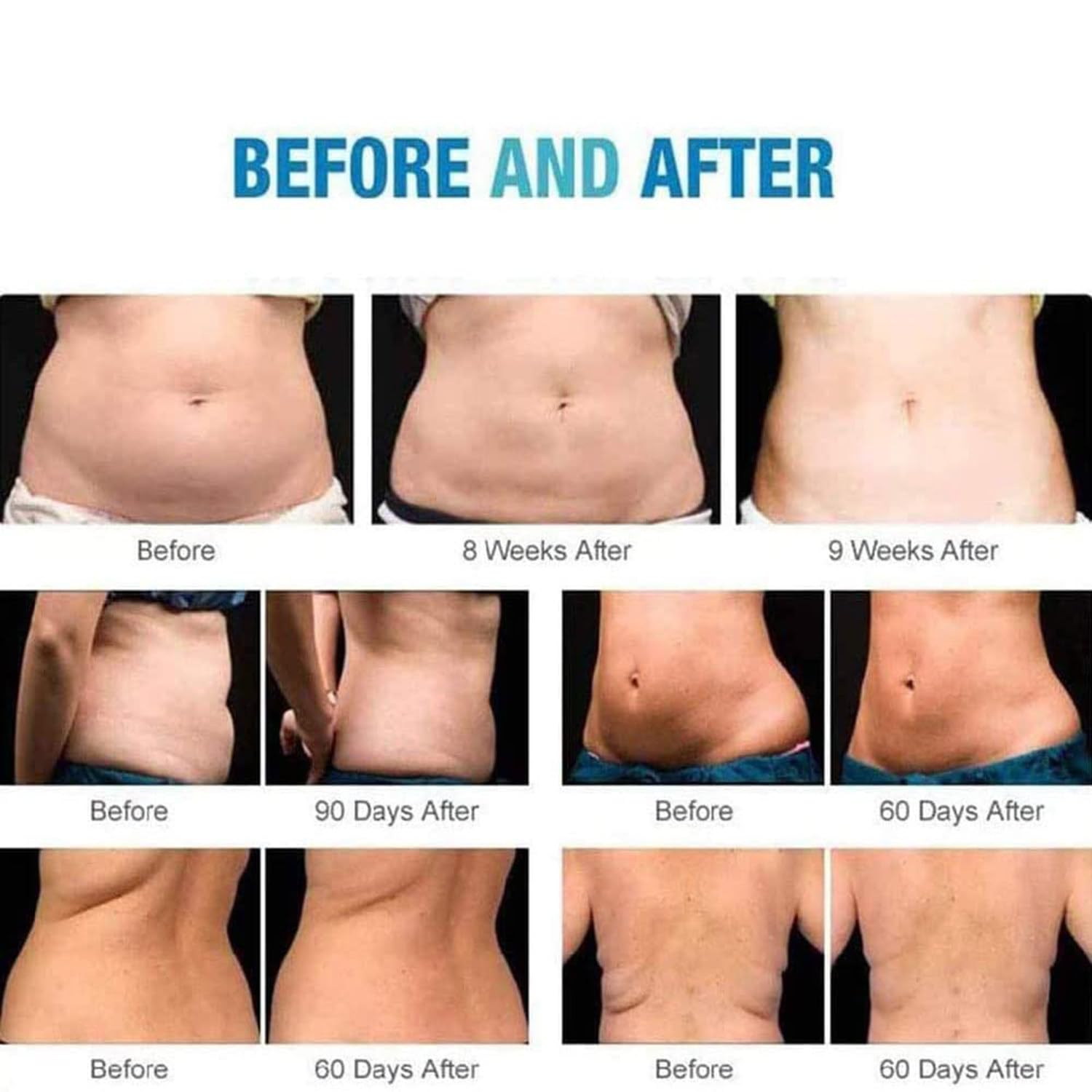 Körperschlankheitsmaschine, Fett-Lipolyse-Instrument, Körperformung, Cellulite-Verbrennung, Spa-Verwendung, mit 3 Betriebsköpfen – Vakuum-Fett-Schlankheitsgerät