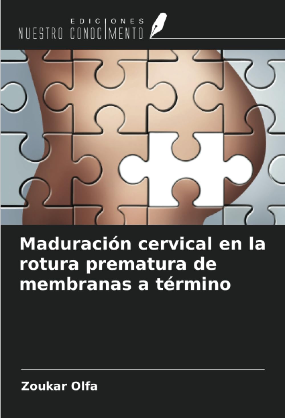 Maduración cervical en la rotura prematura de membranas a término