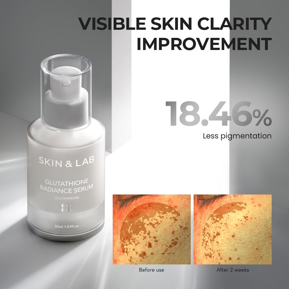 skin&lab glutathione radiance serum [SKIN&LAB] Gluthathione Radiance Serum with Niacinamide and  Alpha-Bisabolol, Even Skin Tone, Brighten Dark Spot and Hyperpigmentation​,  Korean