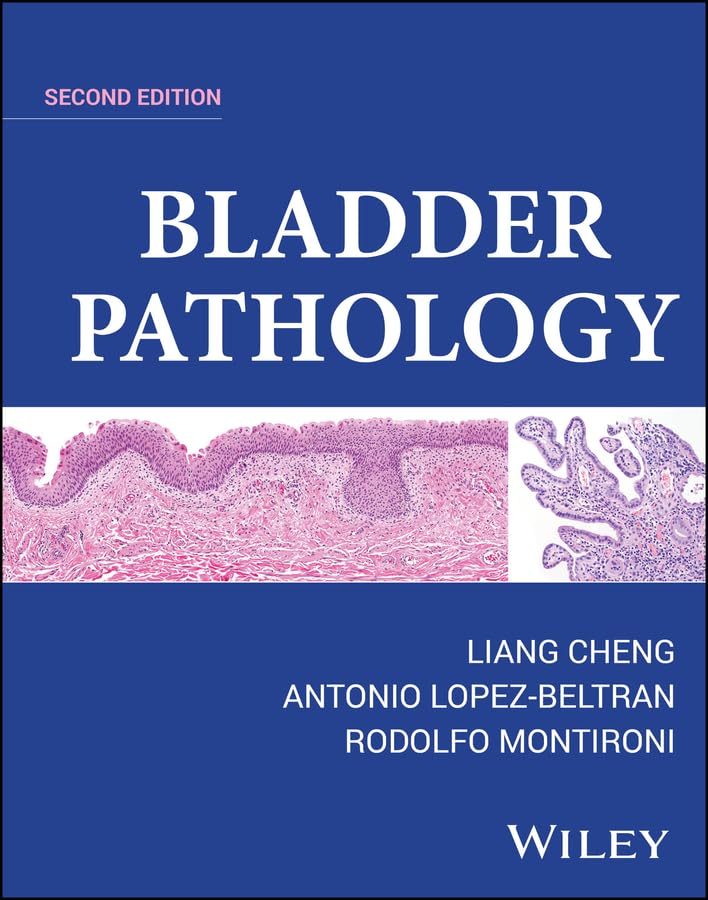 Bladder Pathology (English Edition)