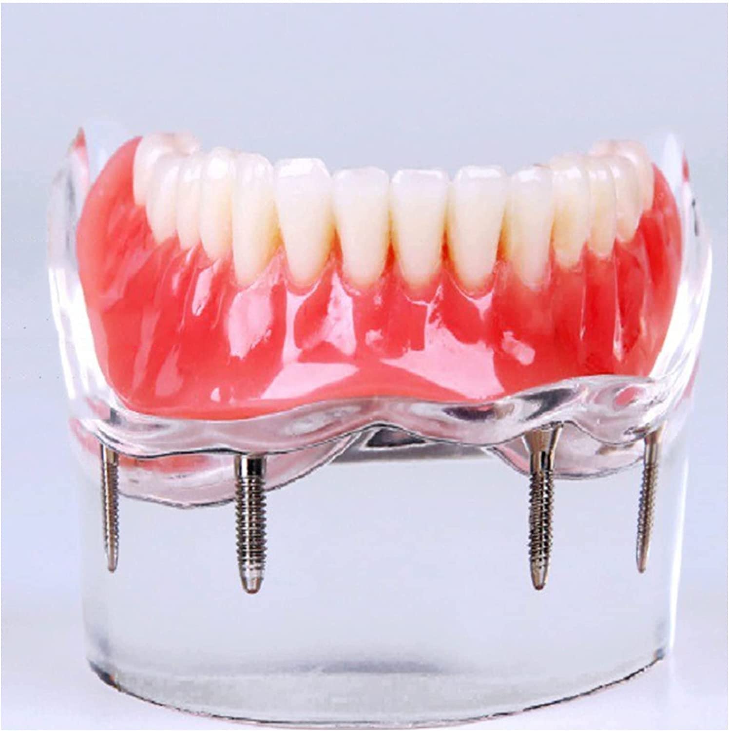 Modello Anatomico, Modello Scheletrico, Modello di Denti Implantari, Modello Didattico per Studio Odontoiatrico, per Protesi su Impianti E Unghie, Modello di De