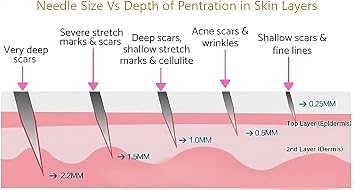 Derma Roller-Titanium 540 Micro Needle Roller for regeneration Beard & Hair Growth,Micro needling Roller,Trimmer Roller,Home Use Skin Care,Facial Wrinkles,Stretch Marks,Skin Care (0.25mm)