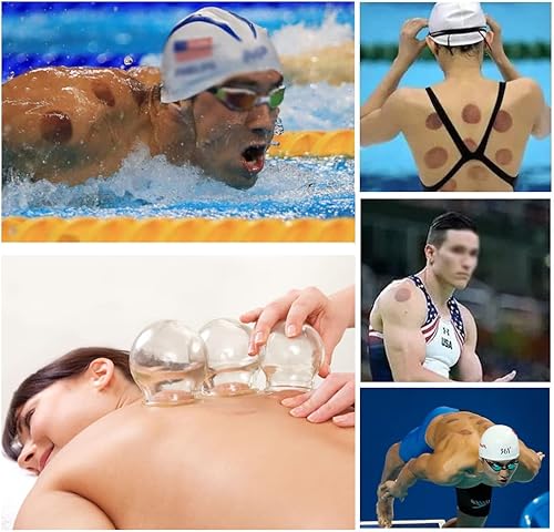 Miniatura 8 de Juegos de terapia de ventosas juego de terapia de ventosas de vidrio de acupunto chino grueso de 14 tazas para profesionales para masajear la