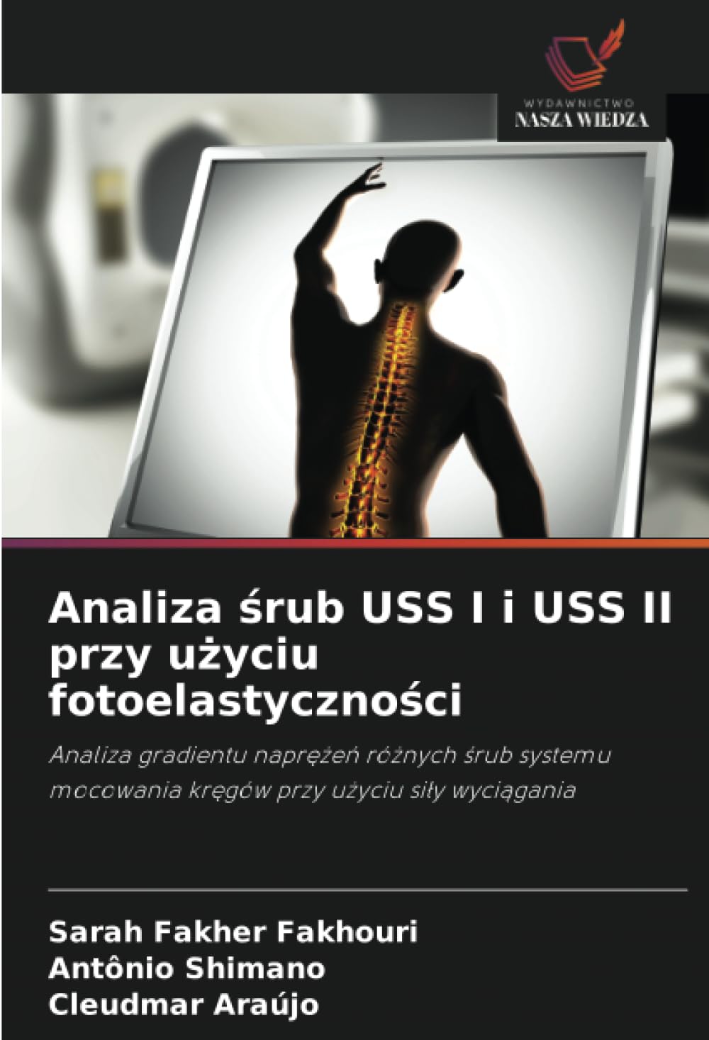 Analiza śrub USS I i USS II przy użyciu fotoelastyczności: Analiza gradientu napr¿¿e¿ ró¿nych ¿rub systemu mocowania kr¿gów przy u¿yciu si¿y wyci¿gania