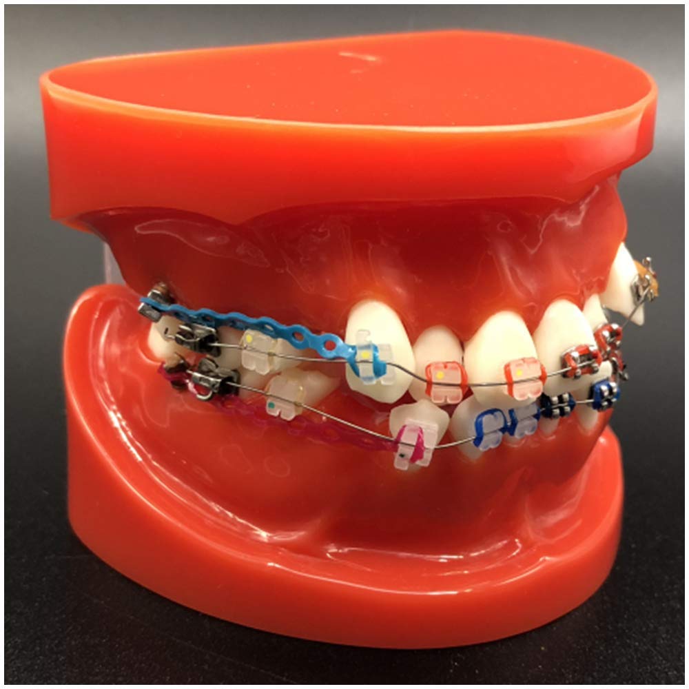 Tipodonte Dentale con Staffe Mentali Modello Odontoiatrico con Legature Modello Odontoiatrico Rosso Insegnare Strumenti di Studio per L'insegnamento dello Studio