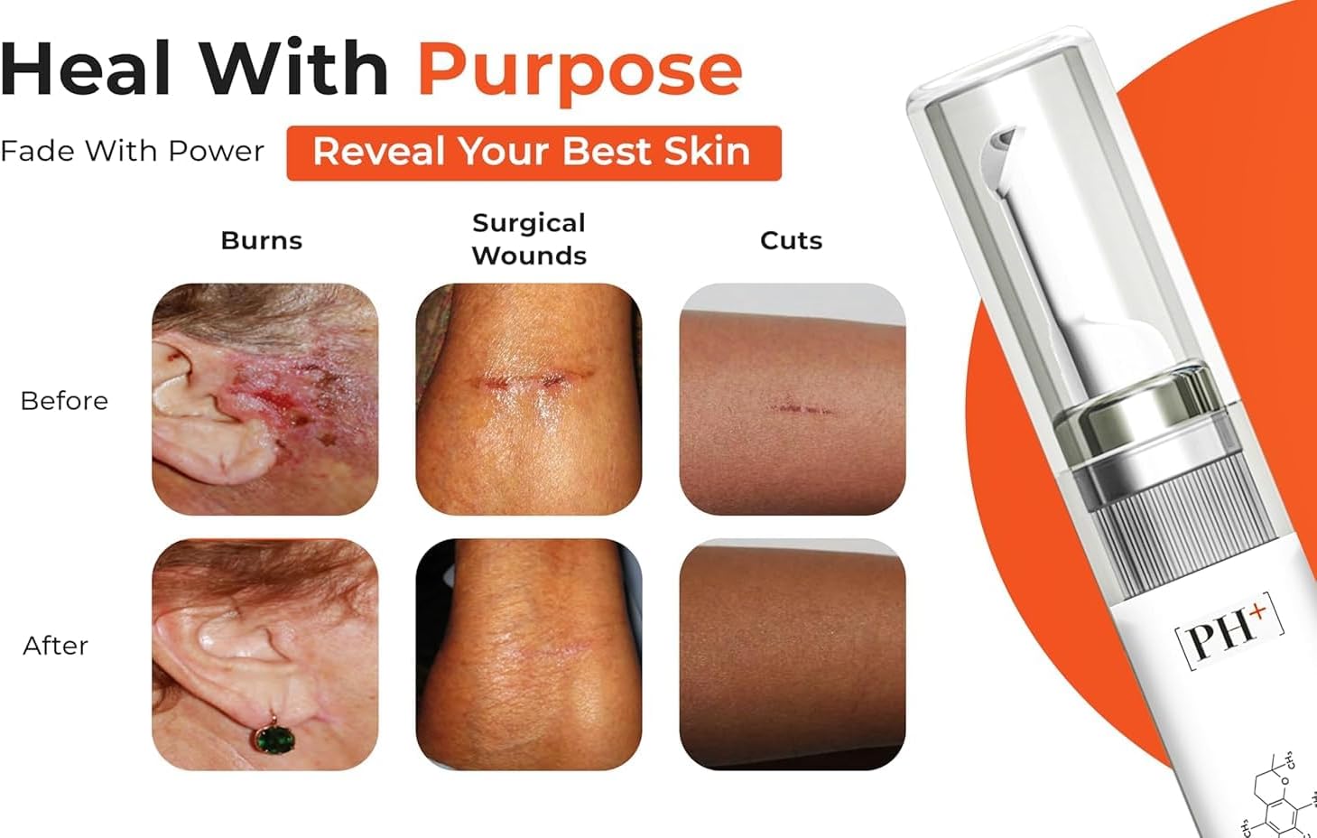 Silicone Scar Gel for Old & New Scars, Keloids, C-Section, Burns, Acne, Surgical Scar Treatment – Cosmetic Formula with Patented Silicone & Sea Berry Oil, Clinically Tested, Made in USA - Image 5