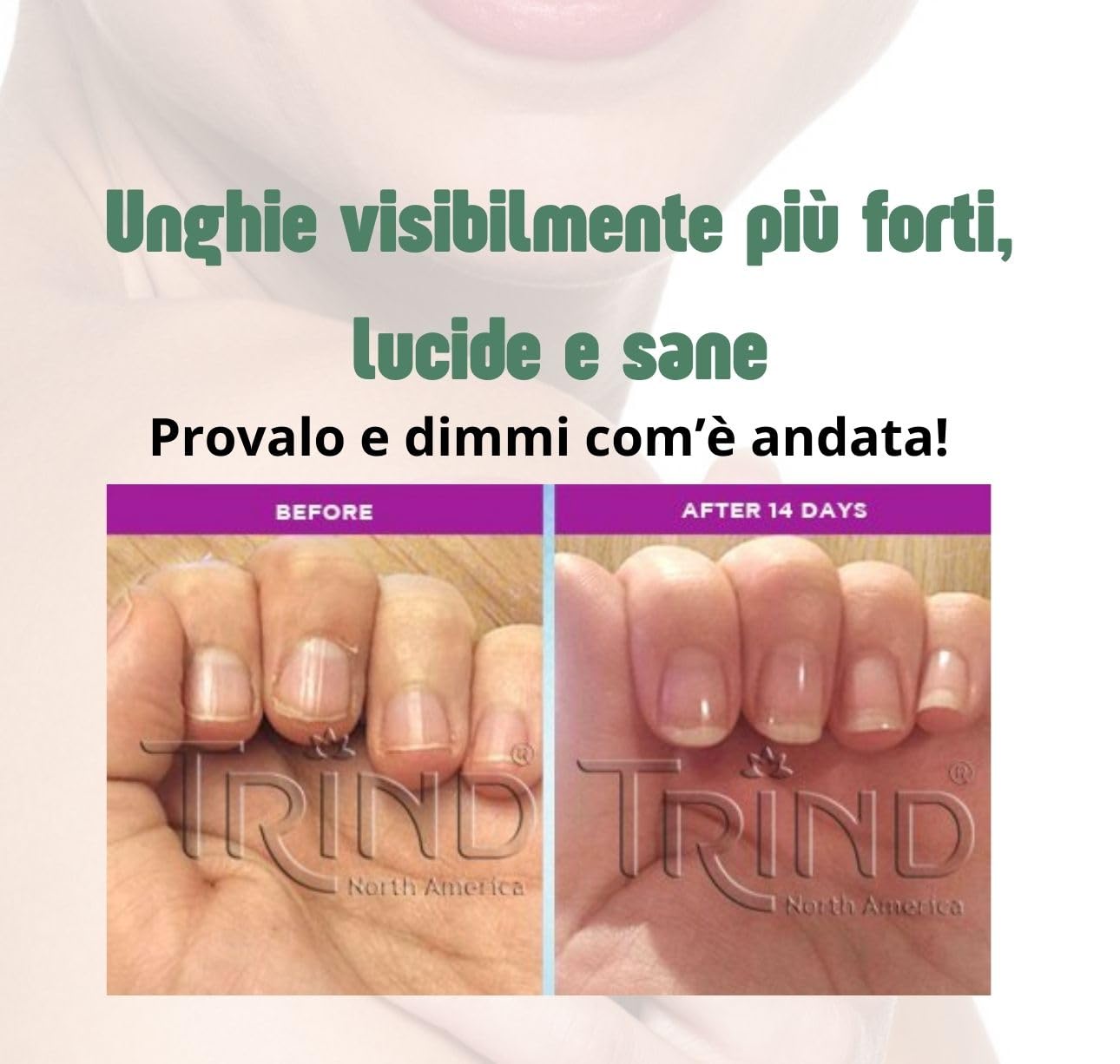 Kit Curativo Rinforzante Unghie | Nail Repair + Nail Balsam + Remover | Unghie Danneggiate da Gel Semipermanente | Ripara, Idrata, Protegge | I Magnifici Tre.