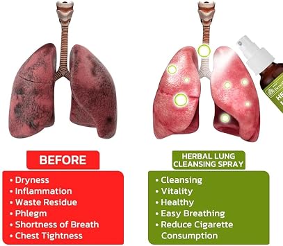 Lung Cleansing Spray Lung Detox Vapor Pen Herbal Diffuser for Respiratory Support, 30ml Detox Mist To Clear Airways, Reduce Inflammation Portable, Travel-friendly for Daily Care