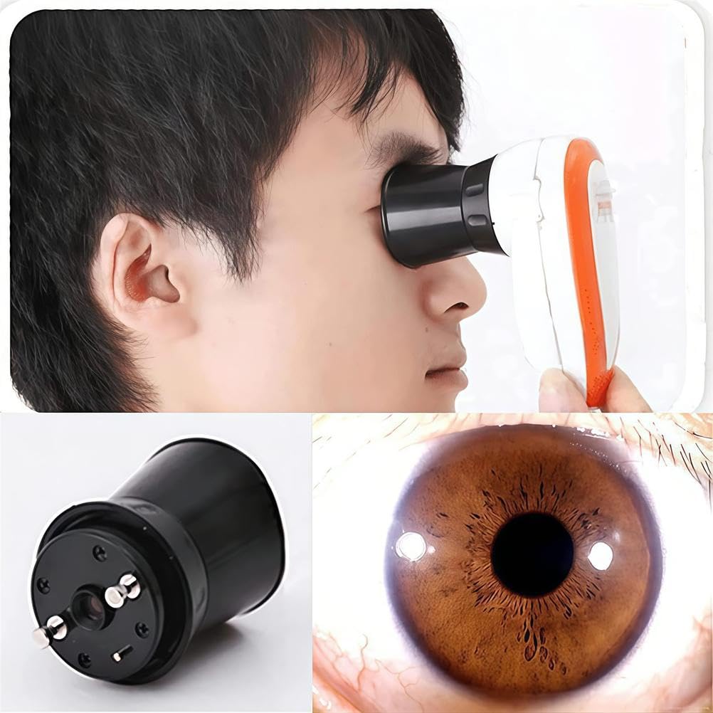 Cámara USB de análisis de iris con software profesional para un examen detallado de los ojos