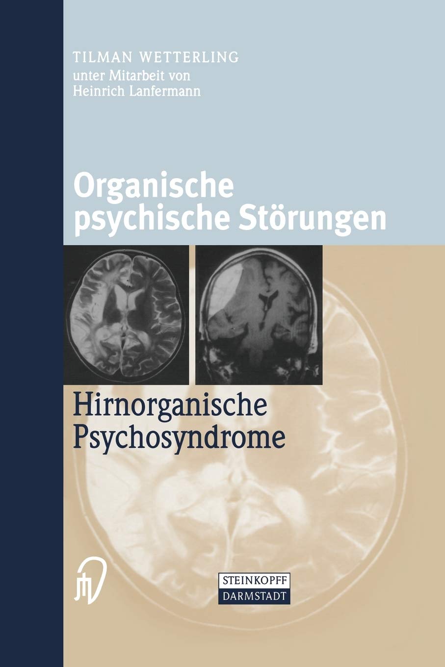 Organische psychische Störungen: Hirnorganische Psychosyndrome