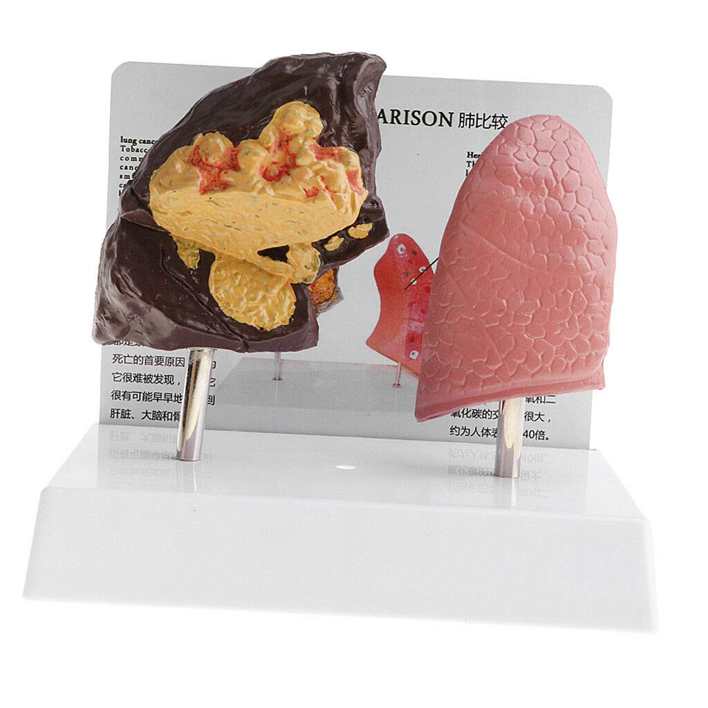 Lab Ornament Human Normal & Pathological Lung Medical Model Minify 1 Time