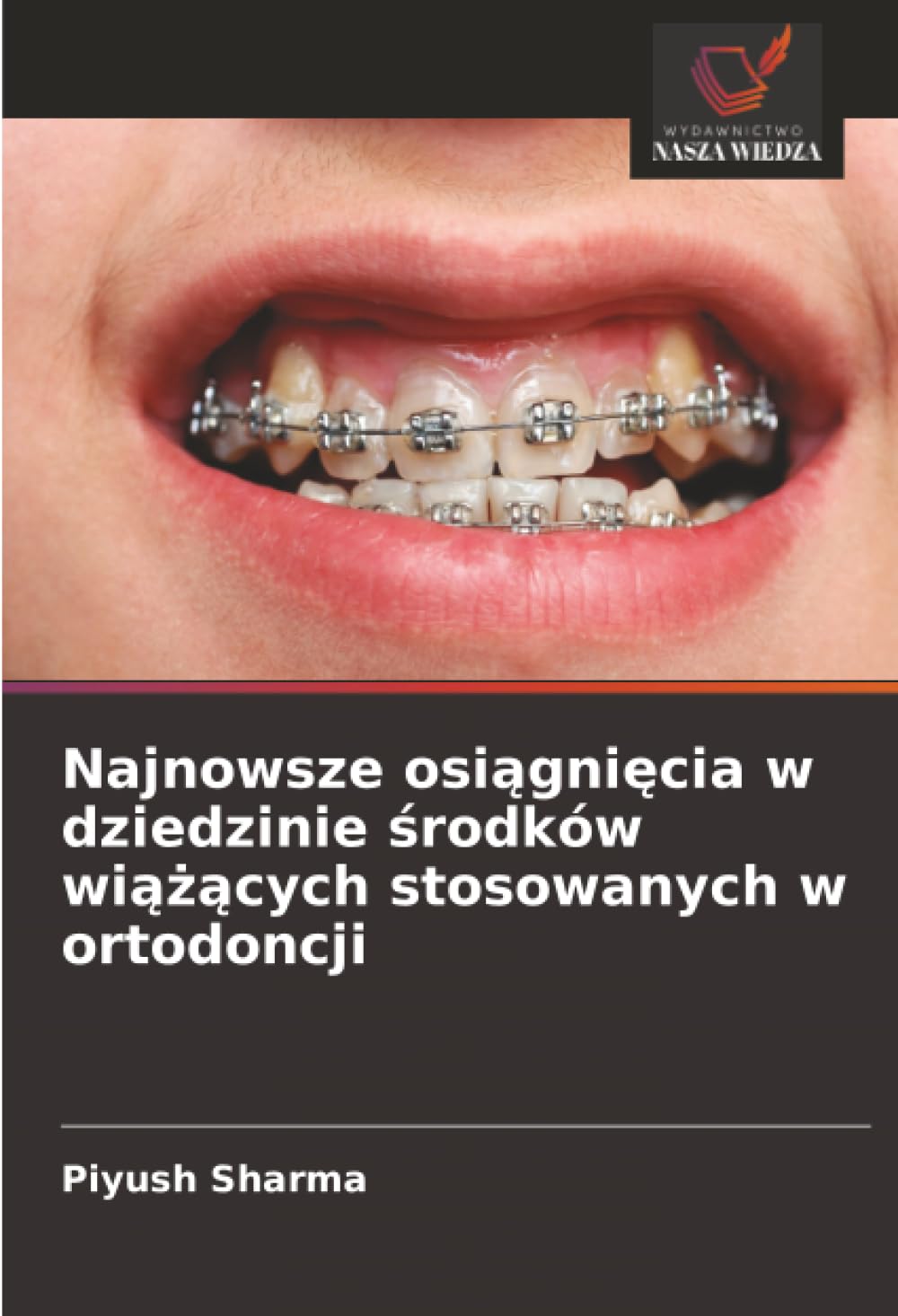 Najnowsze osiągnięcia w dziedzinie środków wiążących stosowanych w ortodoncji