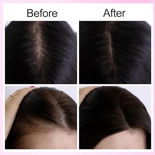 Miniatura 7 de Champú para el crecimiento del cabello con aceite de romero,Champú de agua de arroz con infusión de proteína de arroz, aceite de argán biotina,