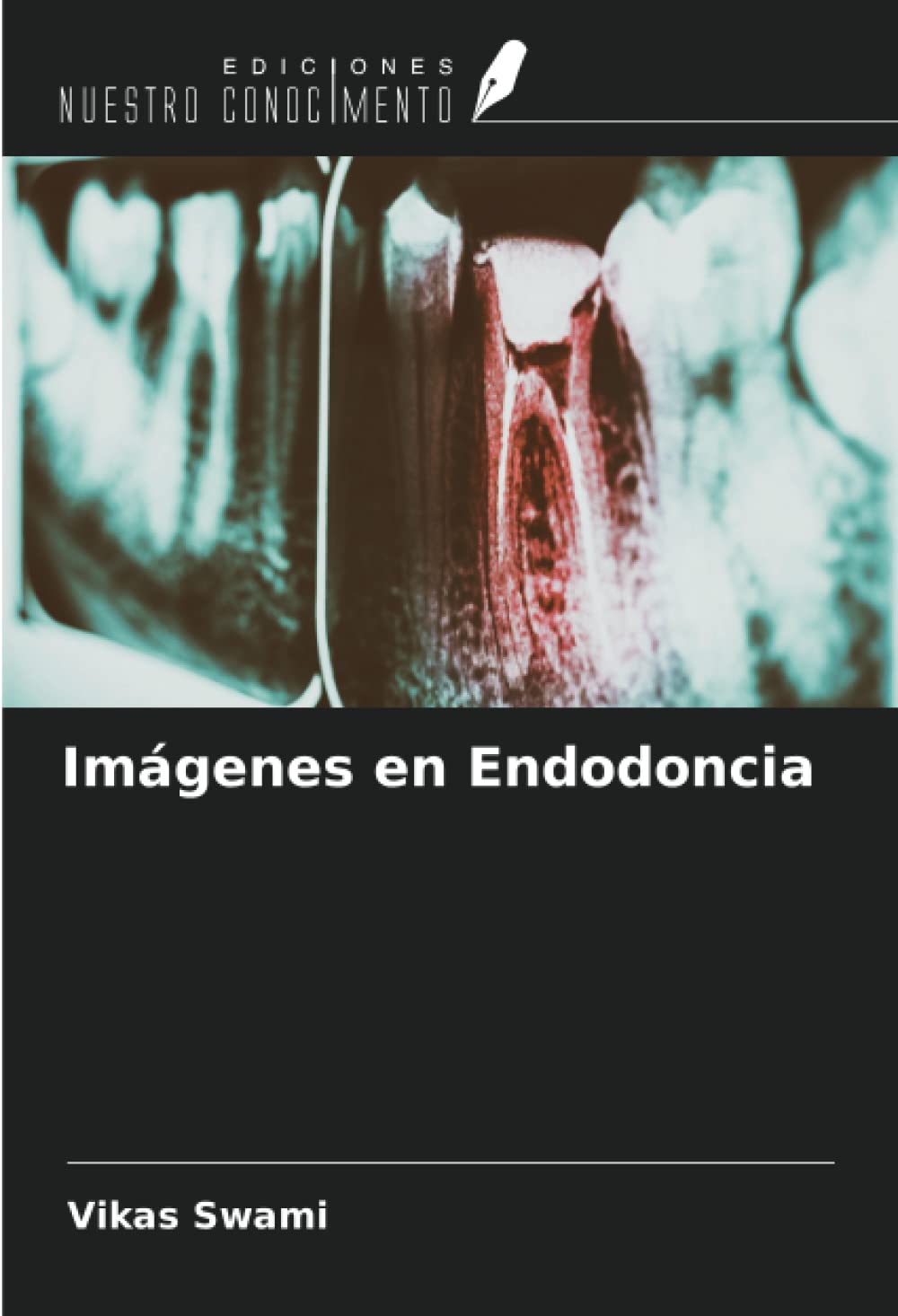 Imágenes en Endodoncia