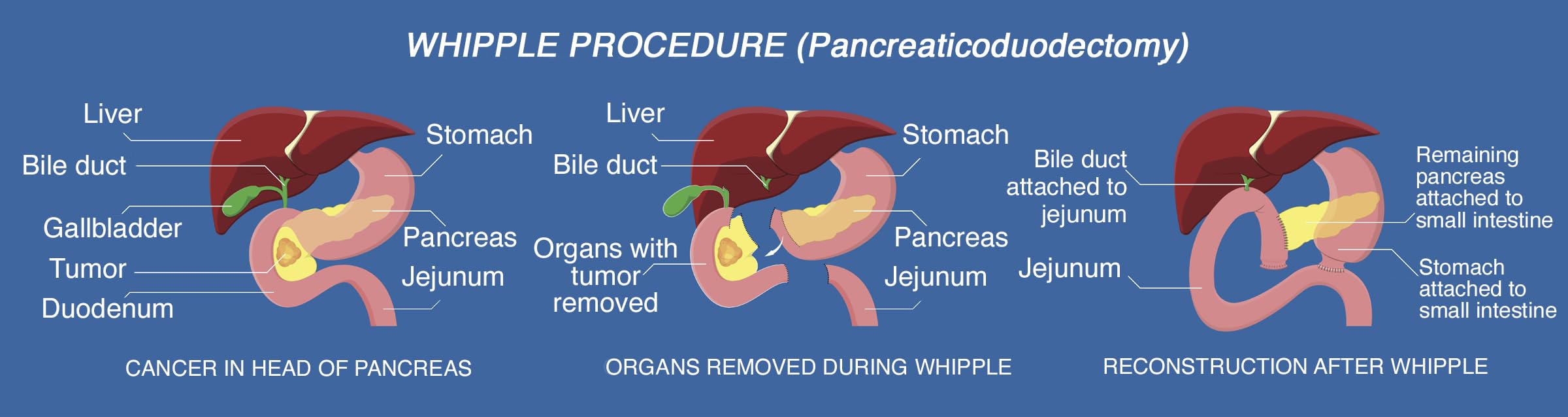 Gastroenterology Made Ridiculously Simple