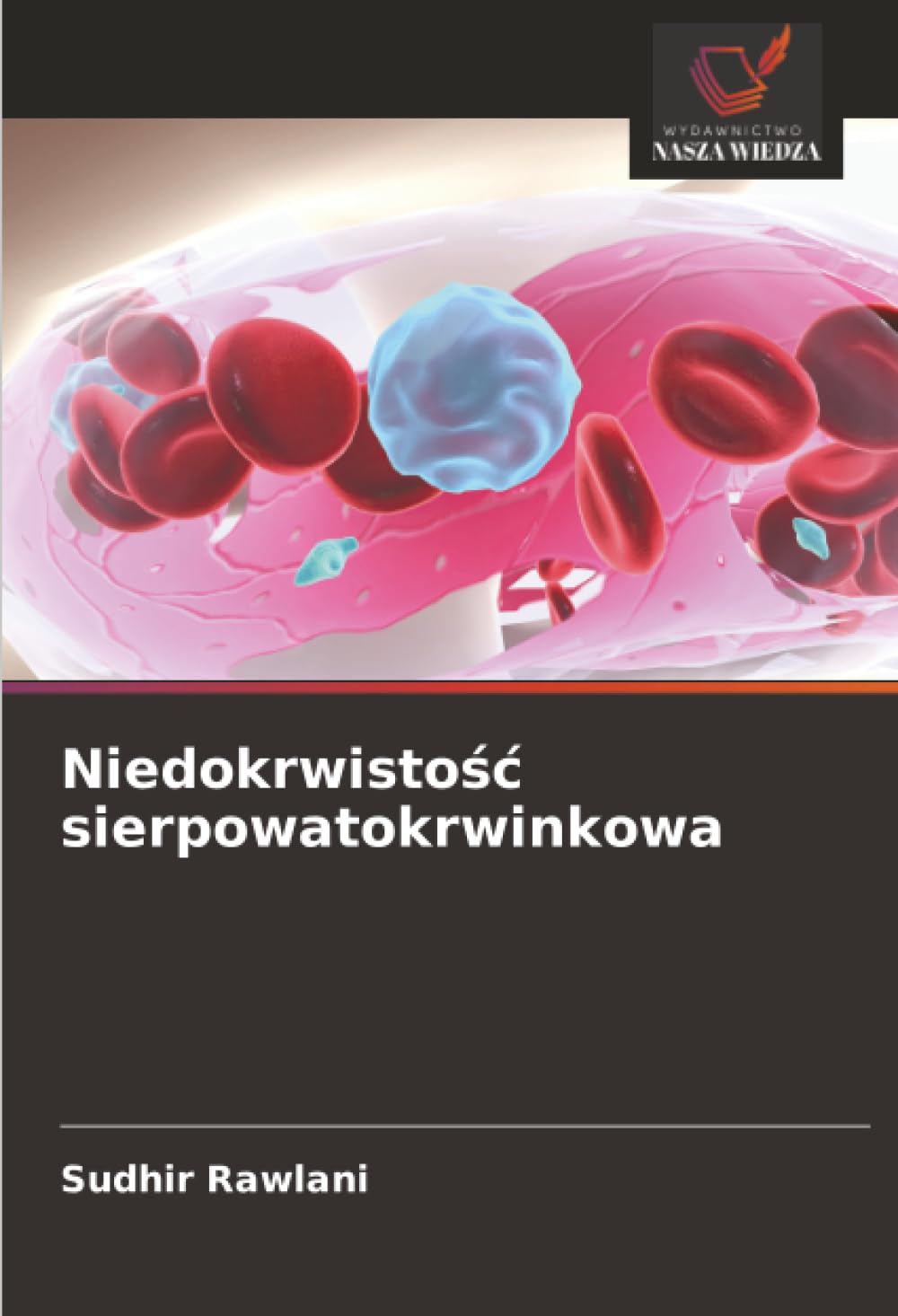 Niedokrwisto¿¿ sierpowatokrwinkowa