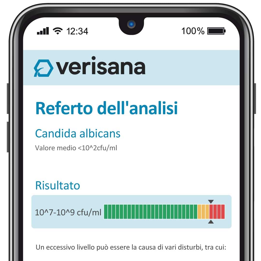 Test per Candida Verisana | Test delle feci + tampone linguale per rilevazione Candida albicans, Candida spec, Geotrichum candidum, muffe | Test per infezioni fungine in feci e cavo orale.