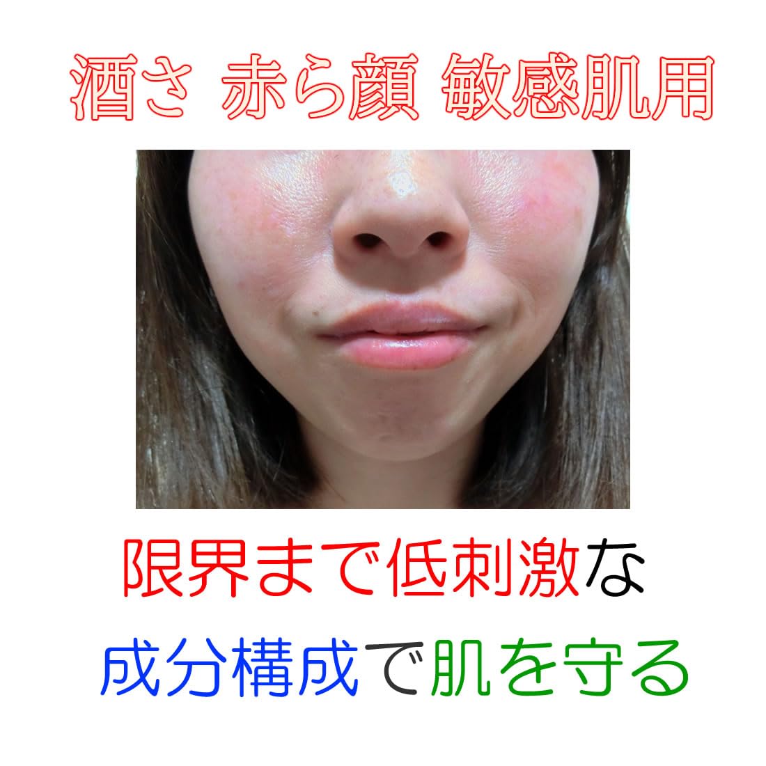 Amazon | SILK 酒さ 敏感肌用 クレンジング 界面活性剤（洗浄剤）不