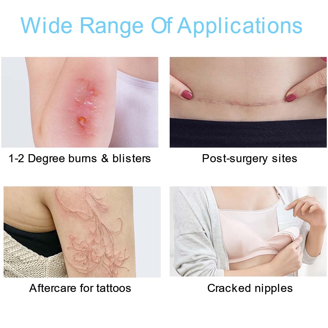 Hydrogel Burn Dressing with Border 4"x4" Self-Adhesive Waterproof Hydrocolloid Wound Dressings Patch Bandages Relief for Minor Burns, Cuts & Abrasions Pack of 5 — Amazon image 3