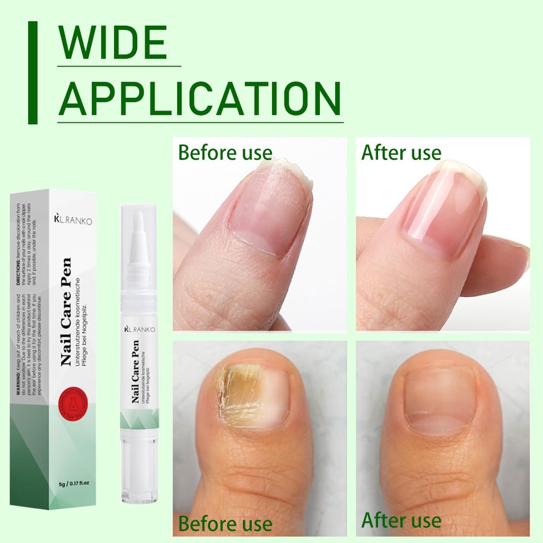 2 Pezzi Nail Care Pen, Penna per la Cura Delle Unghie