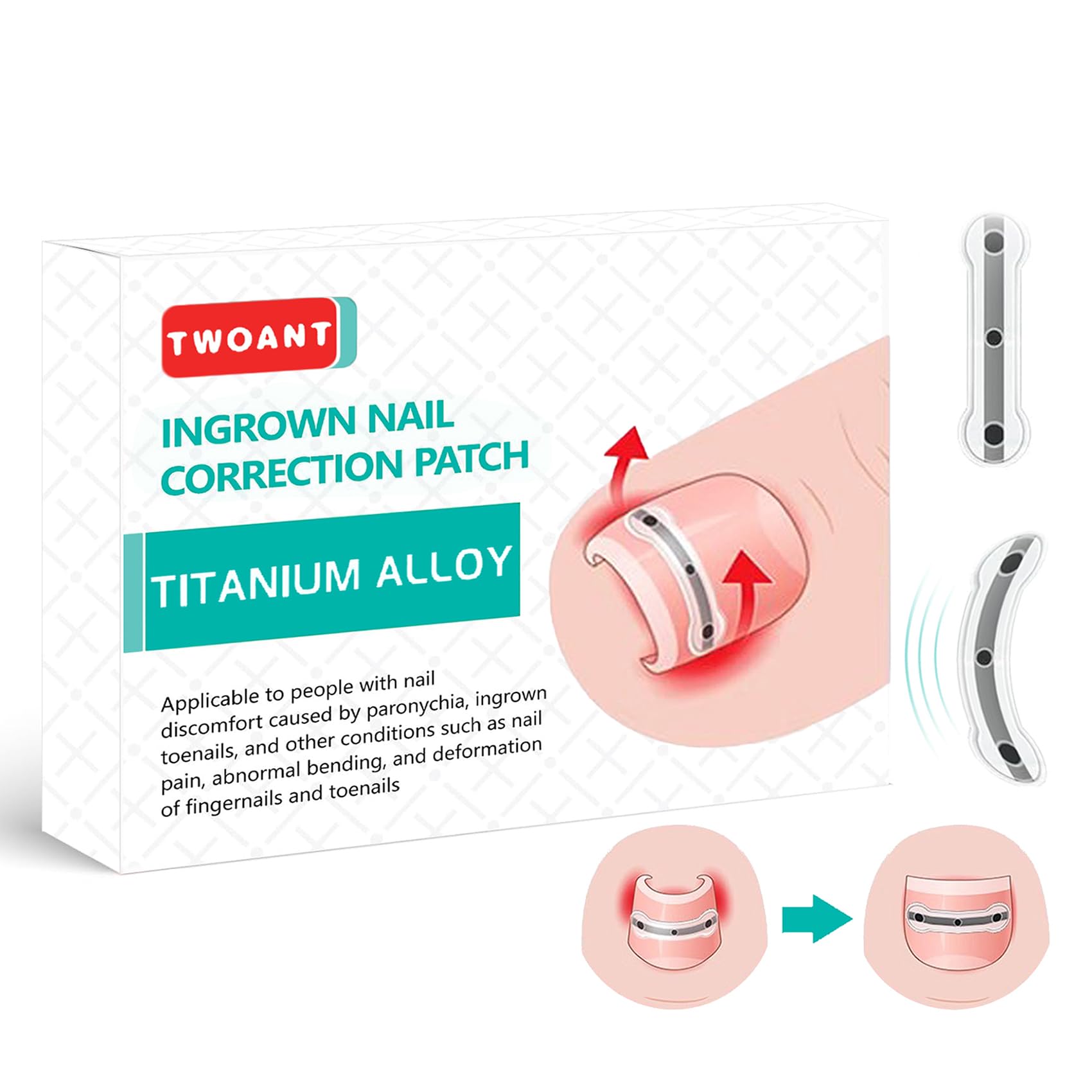 Ensemble Professionnel Pour la Correction des Ongles Incarnés : Patchs de Correction des Ongles et Outils Efficaces Pour Ongle Incarné