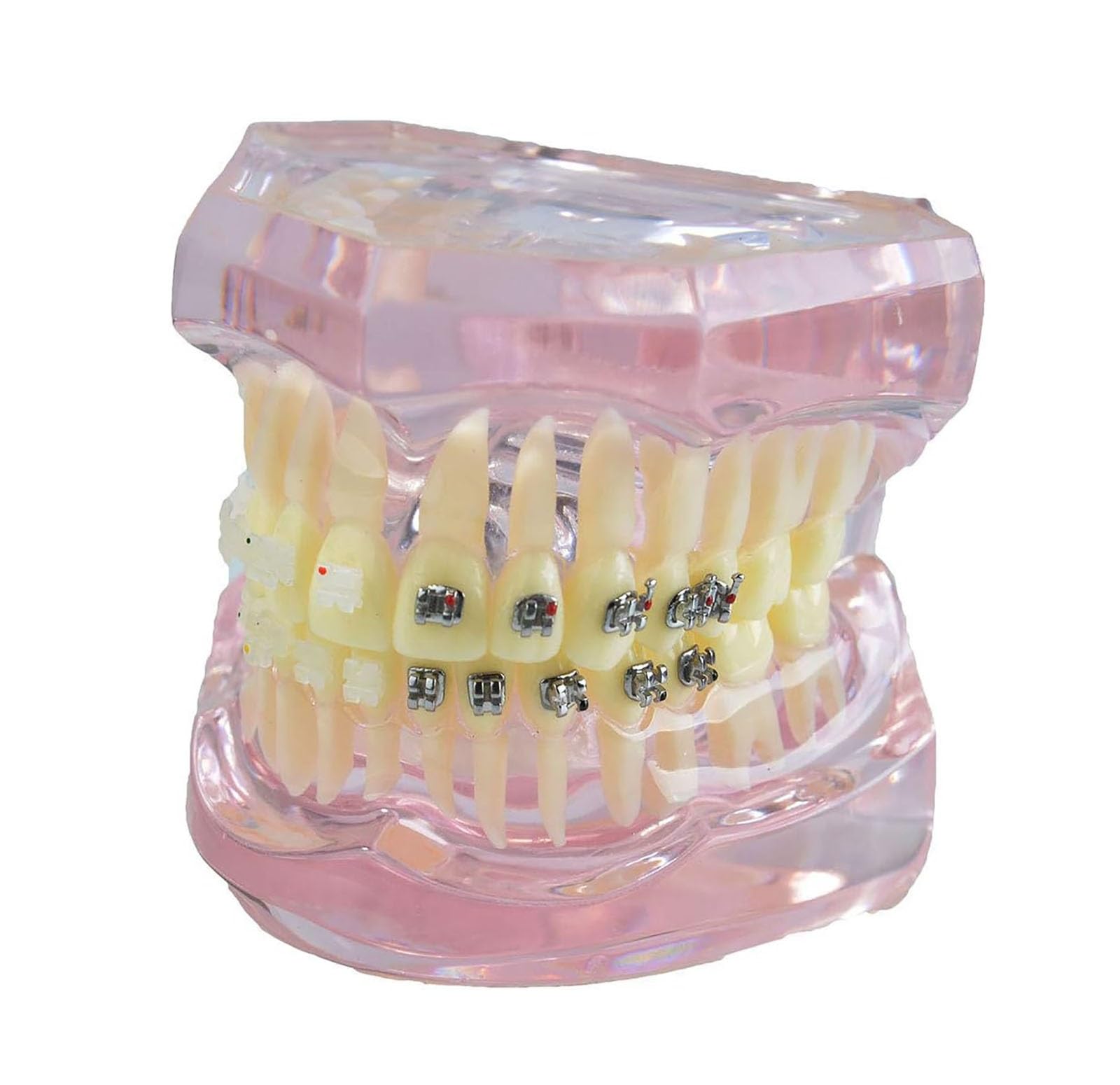 Modello di Dente, Apparecchio Dentale in Metallo E Ceramica Denti Modello, Modello Ortodontico per Adulti Dentale Denti Modello Dentista per Insegnamento di Scienze Studio Odontoiatria Strumenti per (