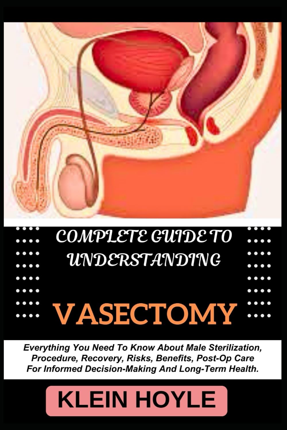 COMPLETE GUIDE TO UNDERSTANDING VASECTOMY: Everything You Need To Know About Male Sterilization, Procedure, Recovery, Risks, Benefits, Post-Op Care For Informed Decision-Making And Long-Term Health.