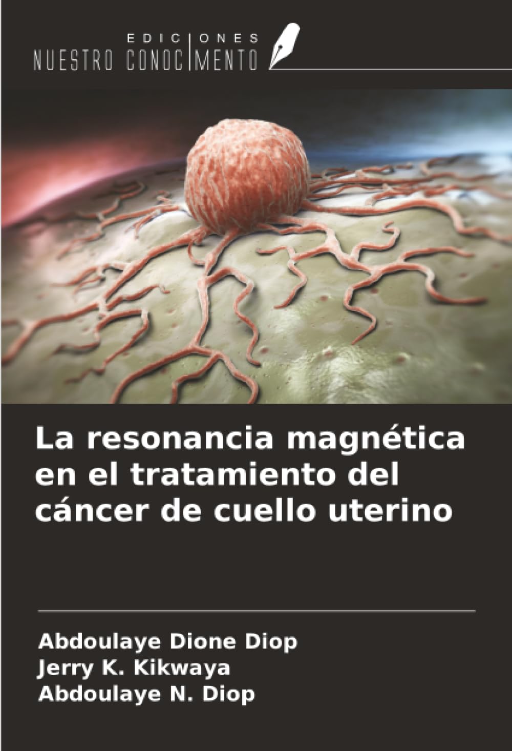 La resonancia magnética en el tratamiento del cáncer de cuello uterino