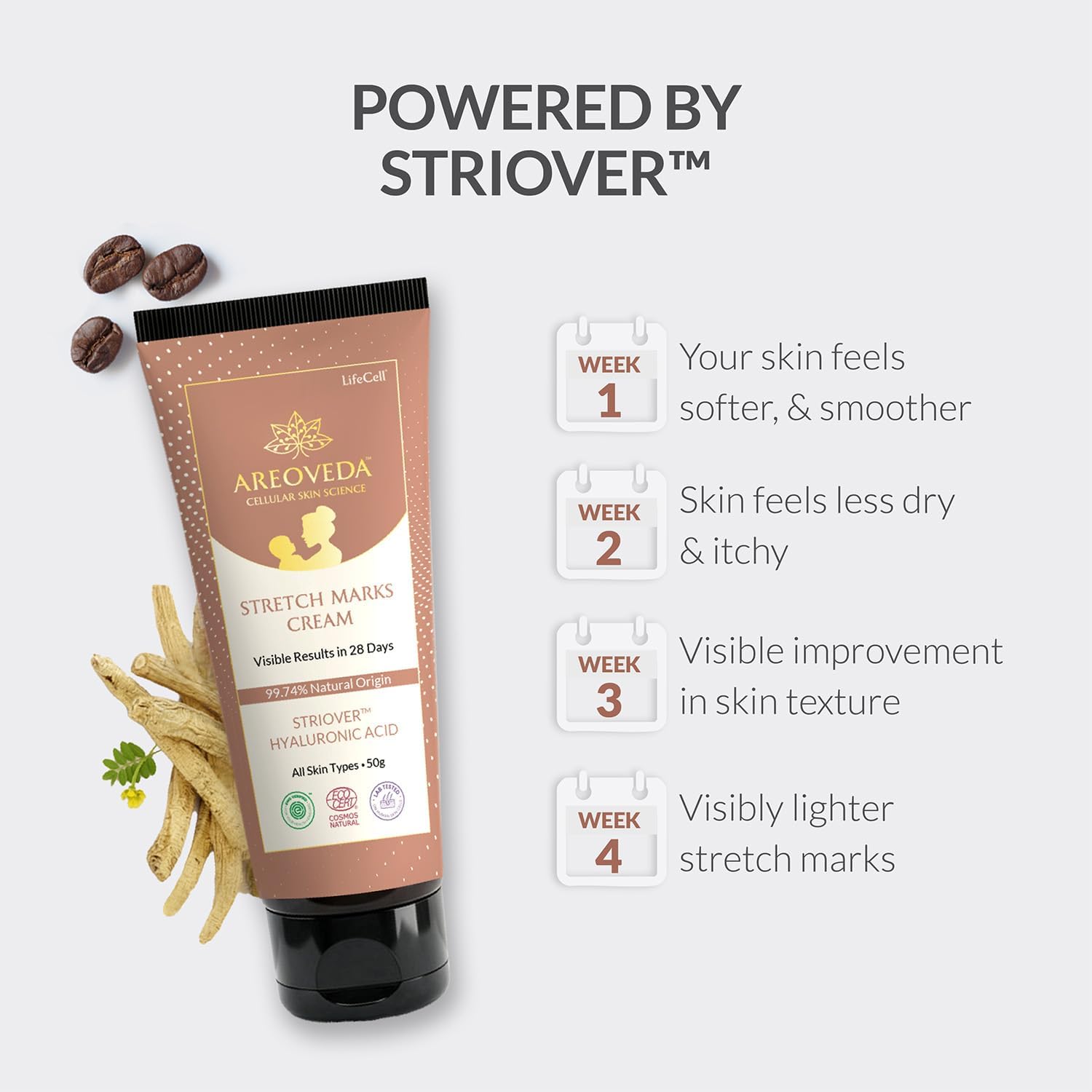 Areoveda Stretch Marks Cream with Striover™ & Hyaluronic Acid, Visible Results in 28 Days, All Skin Types, 50g