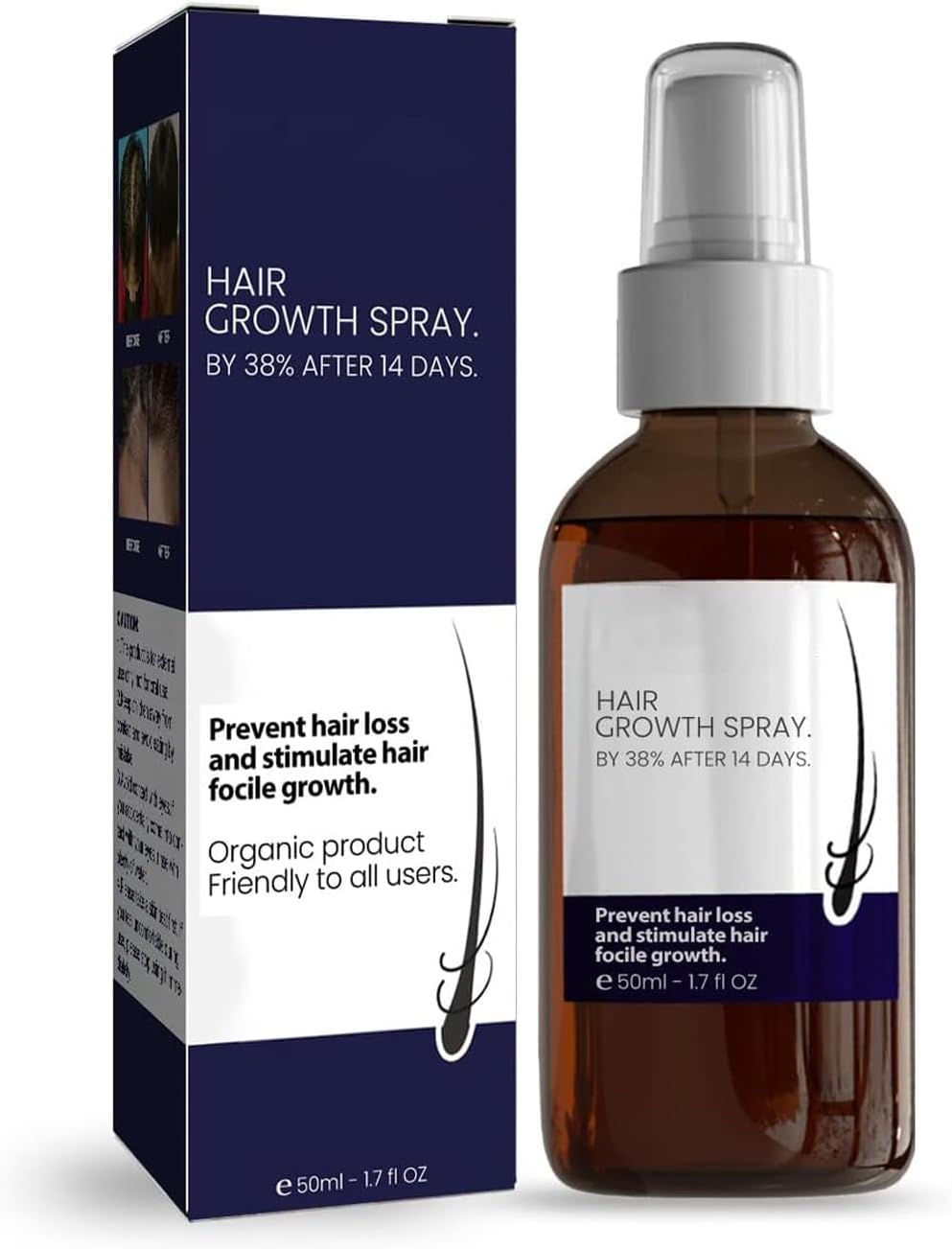 Hair Growth Spray, Natural Regrowth and Thickening Oil for Stronger Hair, Best Growth Products for Women & Men (1Pcs)