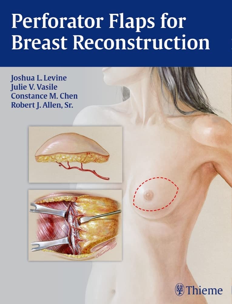 Perforator Flaps For Breast Reconstruction 9781626230941 Medicine perforator-flaps-for-breast-reconstruction-9781626230941-medicine
