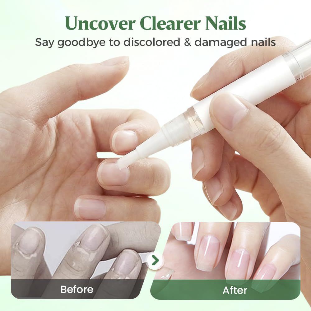 Nagelpilz Stift Original, Schnelle Absorption, präziser Applikator, stärkt und pflegt geschädigte Nägel, geeignet für Hände & Füße (3 stück)