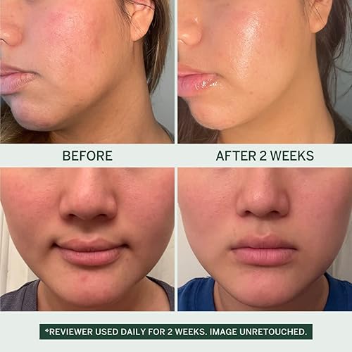 Miniatura 2 de FACETORY Urban Calm Soft Essence - Tónico para el cuidado de la piel hidratante, calmante e hidratante, tónico facial para pieles sensibles, grasas,