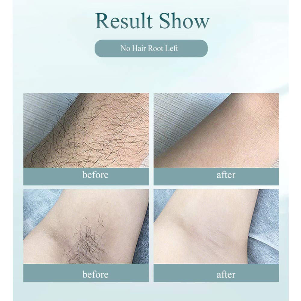 Epilazione Laser 900.000 Flash Depilazione Permanente IPL per Uso Domestico Rimozione indolore dei Capelli per Donne e Uomini Labbra Braccio Ascella Gamba pubica