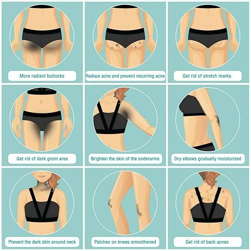 Miniatura 2 de NAKIZ Lively - Crema para glúteos para estrías, manchas oscuras, rodilla, codo, axila, área íntima, 3.53 onzas, ganador del premio, auténtico