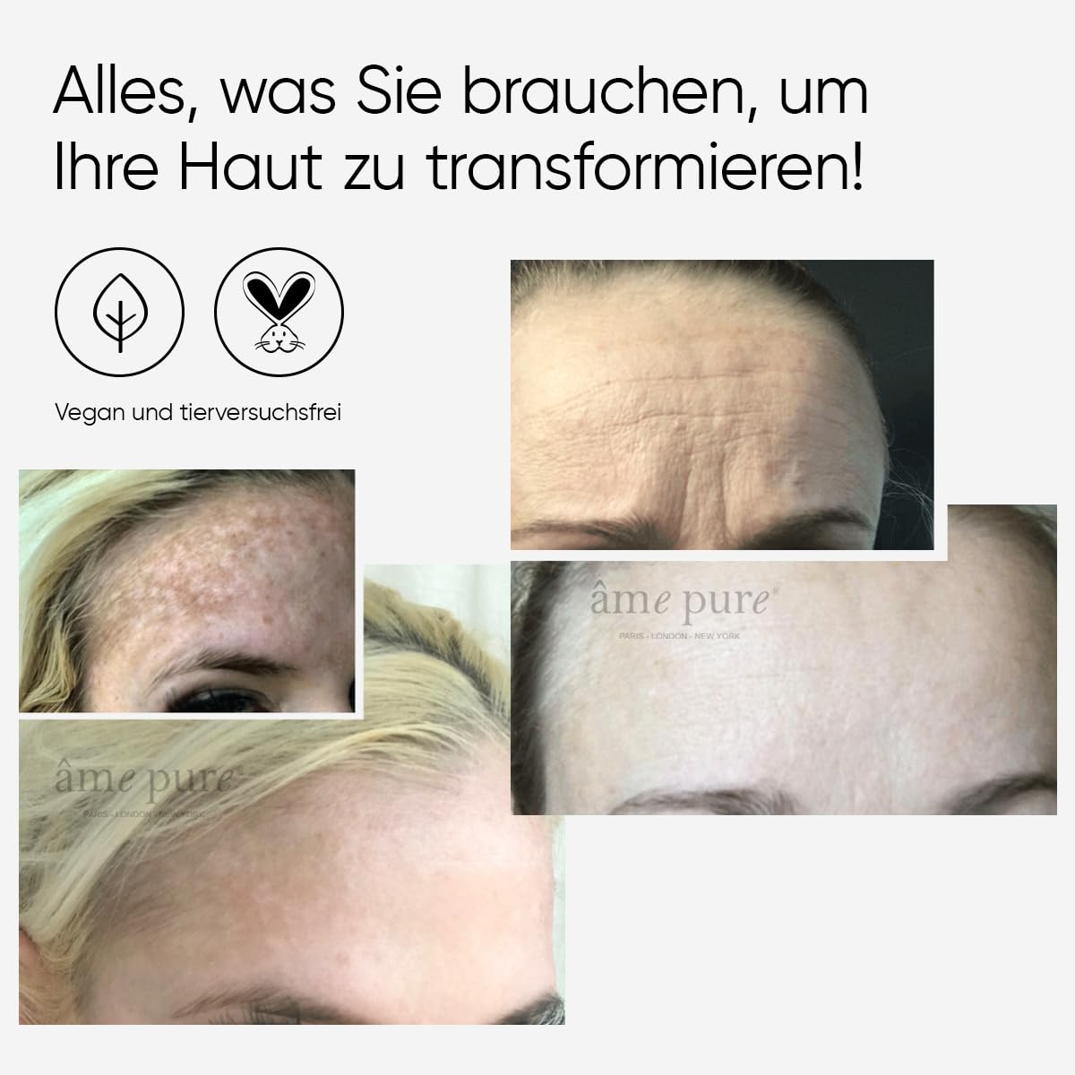 âme pure® WrinklEraser Basic SET 100% natürliche Mikronadelroller-Behandlung gegen Falten (Dermaroller 0.5mm + Gel + Desinfektionsmittel)