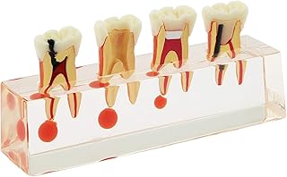 Dentalmall Dental 4-stage Endodontic Treatment Model for Study Teach Teeth Model 4018